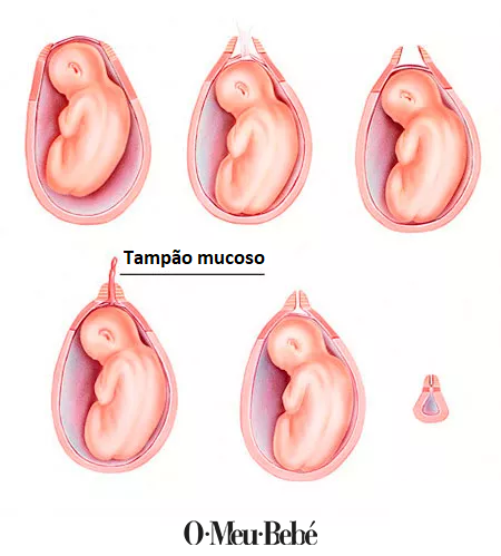 Tampão mucoso