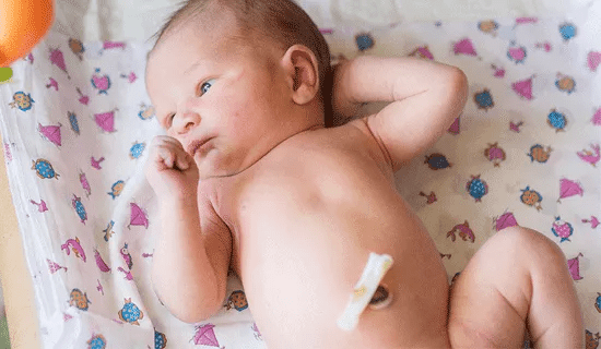 cordon umbilical bebe