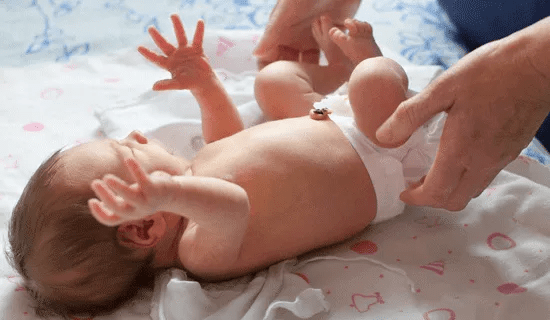 cordon umbilical cura fralda