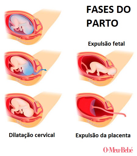 fases do parto