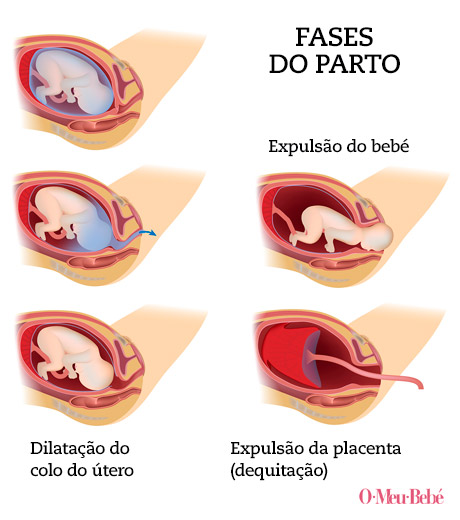 fases parto