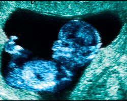 ecografia bebe semana 12ok