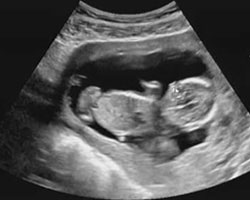 ecografia bebe semana 14ok