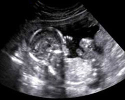 ecografia bebe semana 18ok