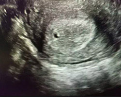 ecografia bebe semana 1ok