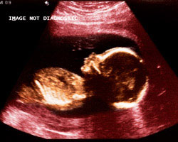 ecografia bebe semana 20ok