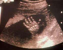 ecografia bebe semana 21ok