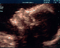 ecografia bebe semana 22ok