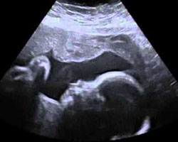 ecografia bebe semana 26ok