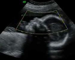 ecografia bebe semana 27ok