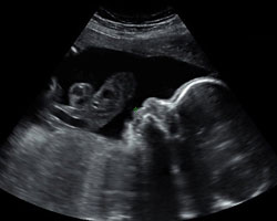 ecografia bebe semana 28ok