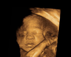 ecografia bebe semana 29ok