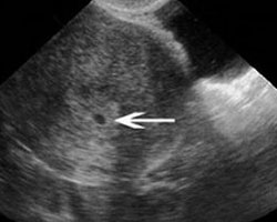 ecografia bebe semana 2ok