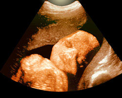 ecografia bebe semana 30ok