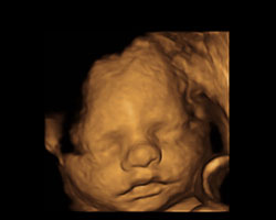 ecografia bebe semana 31ok