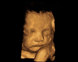 ecografia bebe semana 32ok