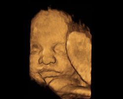 ecografia bebe semana 34ok