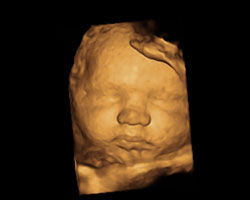 ecografia bebe semana 36ok