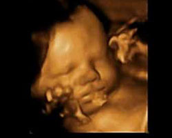 ecografia bebe semana 37ok