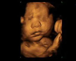 ecografia bebe semana 38ok