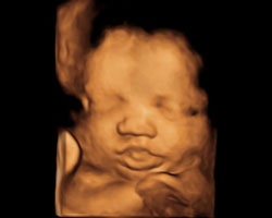 ecografia bebe semana 39ok