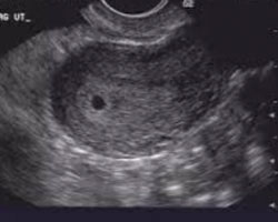 ecografia bebe semana 4ok