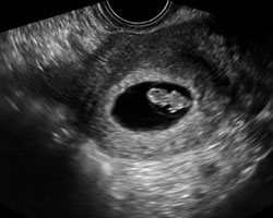 ecografia bebe semana 7ok