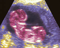 ecografia bebe semana 8ok