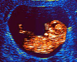 ecografia bebe semana 9ok