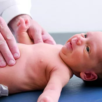 Estenose Hipertrofica Do Piloro Como Afeta O Bebe