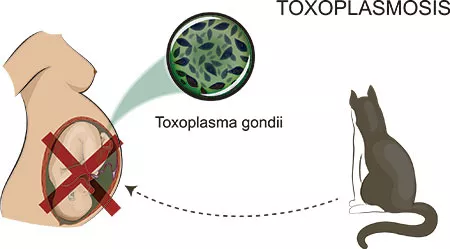 toxoplasmose gravidez