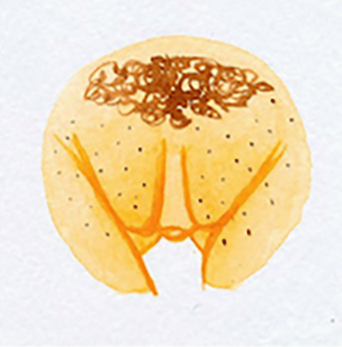 vulva 11