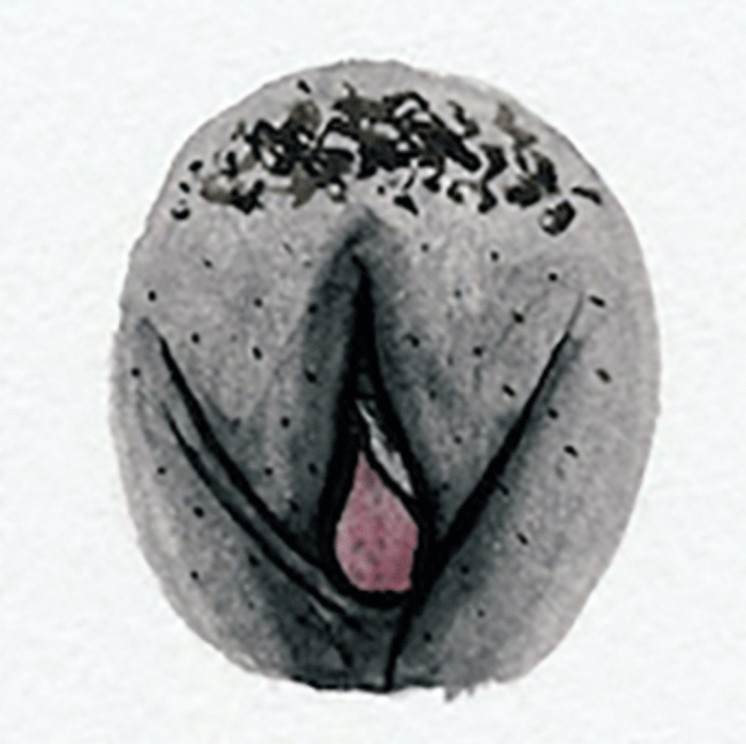 vulva 6